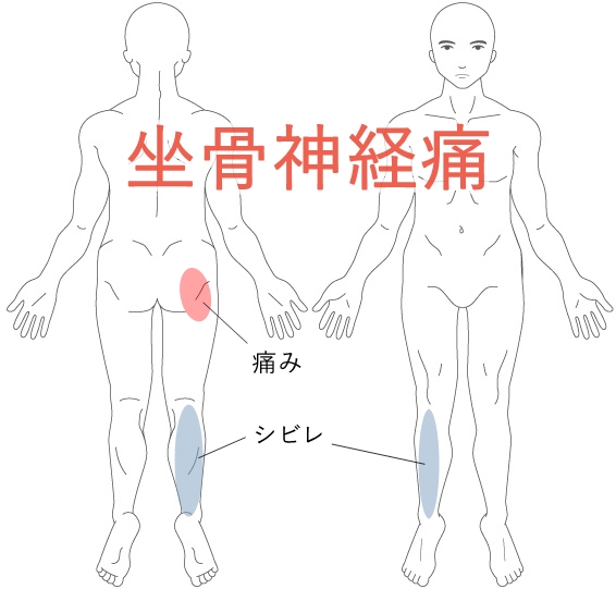 痛い 生理 前 おしり が