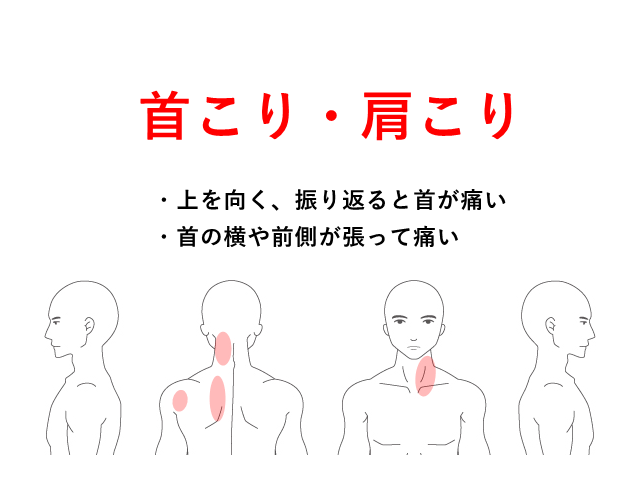 の 付け根 痛い 首 首の痛みその原因と解消法