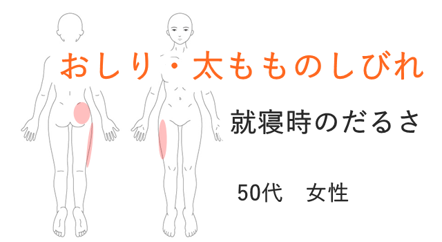 太もも 足のしびれ 神経痛 愛媛県松山市の鍼灸院 はりきゅう専門 鍼灸院めぐる
